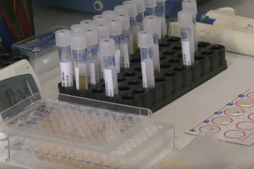 Slučaj gube otvorio pitanja: Kakva je procedura i prevencija zaraznih bolesti?