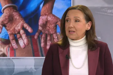 Ministrica Hrstić o 'zata&scaron;kavanju' slučaja gube: 'Nije bilo potrebe obavijestiti javnost'