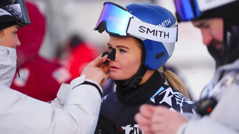 Jedna od najzgodnijih skijašica iznenadila crnim predmetom na licu: Pogledajte o čemu se radi