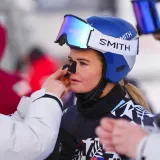 Jedna od najzgodnijih skijašica iznenadila crnim predmetom na licu: Pogledajte o čemu se radi