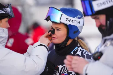 Jedna od najzgodnijih skija&scaron;ica iznenadila crnim predmetom na licu: Pogledajte o čemu se radi