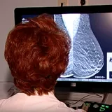 Onkolo&scaron;ki pacijenti bez terapije: &Scaron;alju ih u druge gradove, ali bez putnih tro&scaron;kova