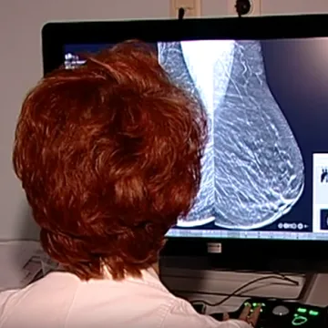 Onkolo&scaron;ki pacijenti bez terapije: &Scaron;alju ih u druge gradove, ali bez putnih tro&scaron;kova