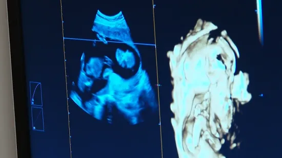 Milijun potpisa, žestoka svađa i glasanje koje trese EU: Pravo na pobačaj ili kultura smrti?