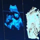 Milijun potpisa, žestoka svađa i glasanje koje trese EU: Pravo na pobačaj ili kultura smrti?