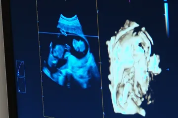 Milijun potpisa, žestoka svađa i glasanje koje trese EU: Pravo na pobačaj ili kultura smrti?