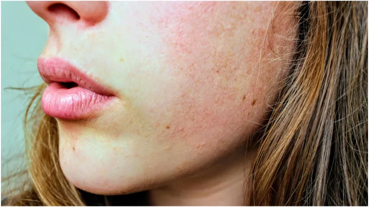 Dermatolozi upozoravaju na viralni trend njege kože: 'Dugoročno uzrokuje ozbiljnu &scaron;tetu'