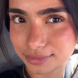 Snimila je na licu muku koja mnogim curama stvara nelagodu, video skupio 30 milijuna pregleda