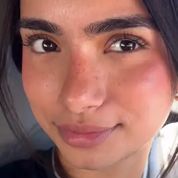 Snimila je na licu muku koja mnogim curama stvara nelagodu, video skupio 30 milijuna pregleda