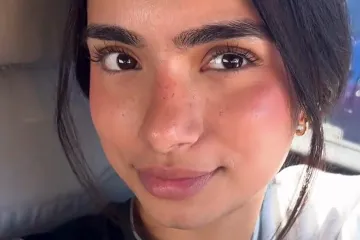 Snimila je na licu muku koja mnogim curama stvara nelagodu, video skupio 30 milijuna pregleda