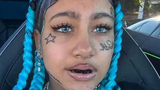 Kći Kim Kardashian zabrinula pratitelje: Svi pričaju o njenim zubima s dijamantima