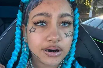 Kći Kim Kardashian zabrinula pratitelje: Svi pričaju o njenim zubima s dijamantima