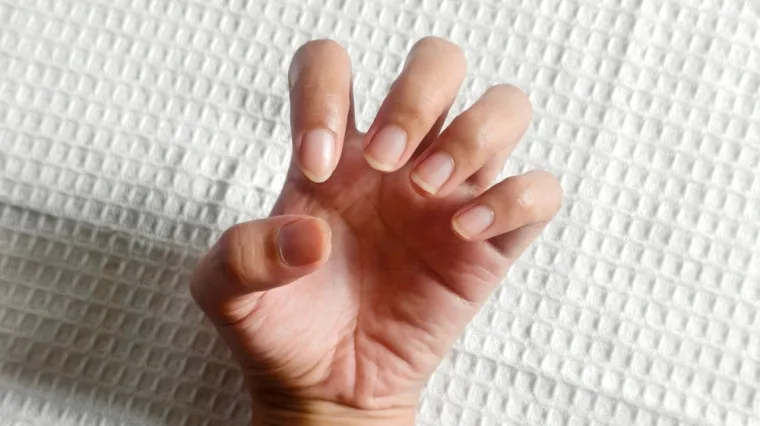 Jednostavan test prstima mogao bi pomoći u ranom otkrivanju raka pluća: 'Važno je ovo'