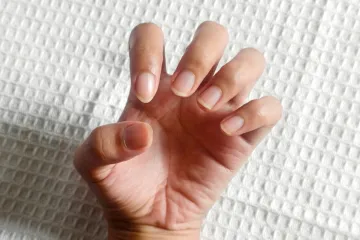 Jednostavan test prstima mogao bi pomoći u ranom otkrivanju raka pluća: 'Važno je ovo'