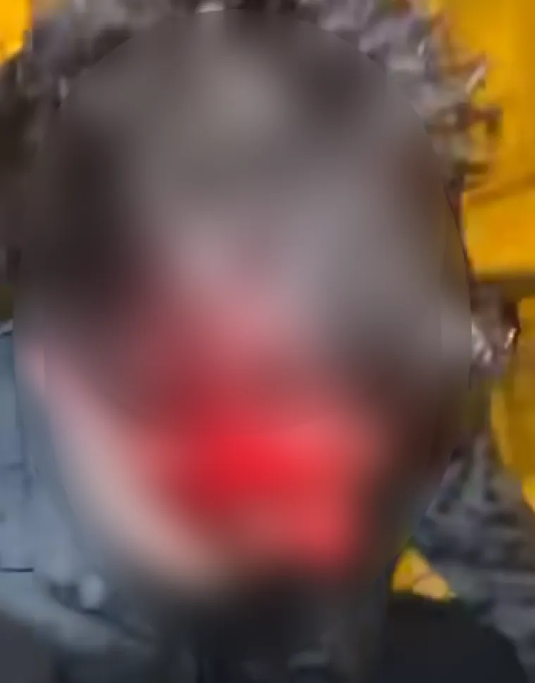 Stravične scene iz Zagreba! Za&scaron;titar brutalno pretukao mladića? Dru&scaron;tvenim mrežama &scaron;iri se grozna snimka