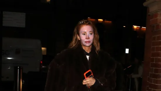 &Scaron;to se dogodilo s licem?! Poznata ljepotica se pojavila u neprepoznatljivom izdanju