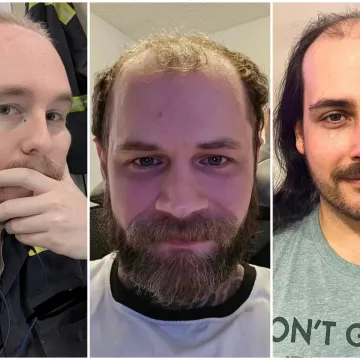 Ćelavite? Postoji divno mjesto na internetu gdje će vam tisuće ljudi pružiti podr&scaron;ku i utjehu