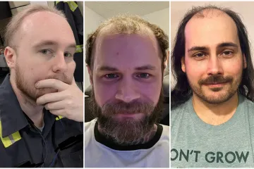 Ćelavite? Postoji divno mjesto na internetu gdje će vam tisuće ljudi pružiti podr&scaron;ku i utjehu