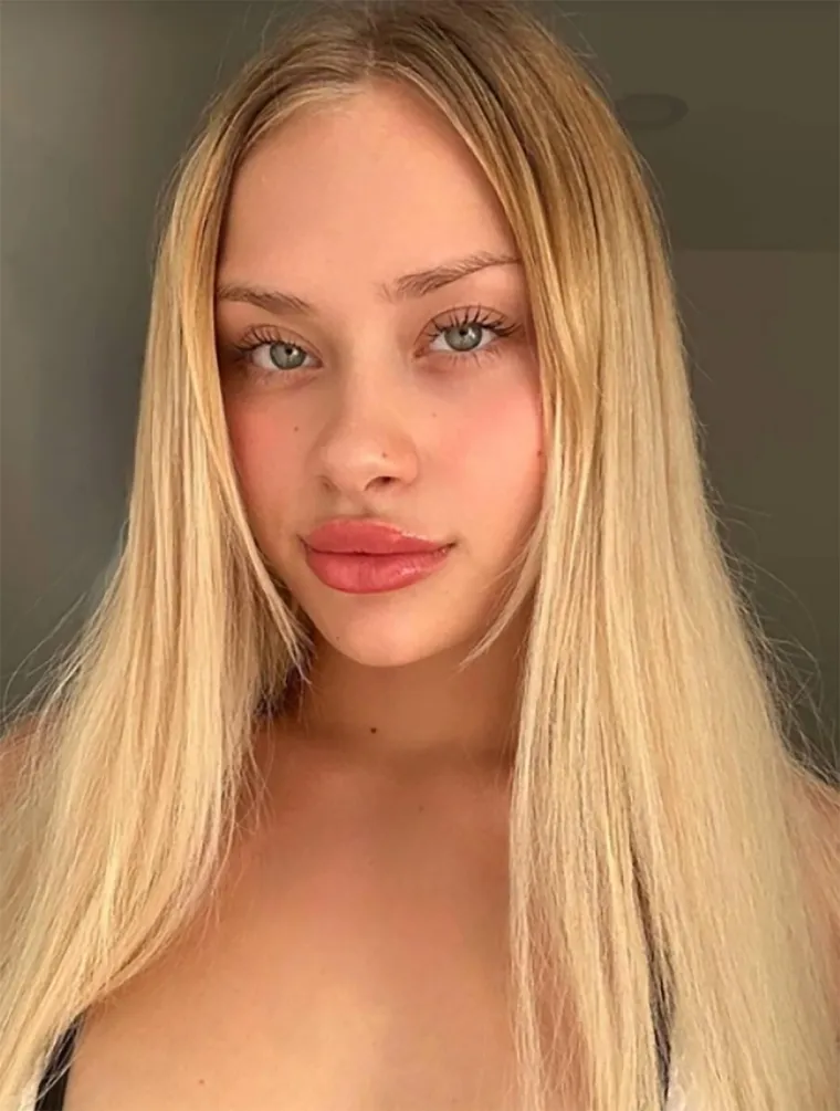 Manekenka proživjela zastra&scaron;ujuće iskustvo na zabavi za odrasle: Evo kako danas izgleda