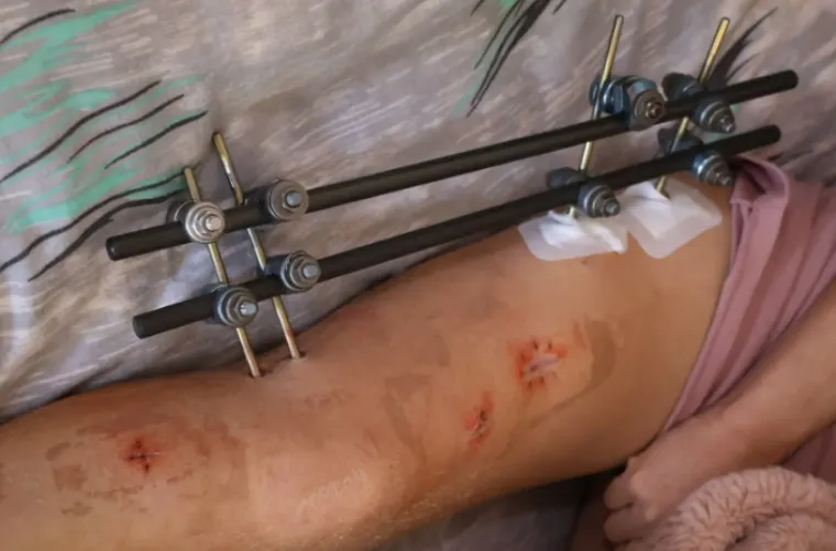 Stravična ispovijest iz Međimurja: 'Dva puta su me oživljavali... Rekao je da će mi pobiti sve'