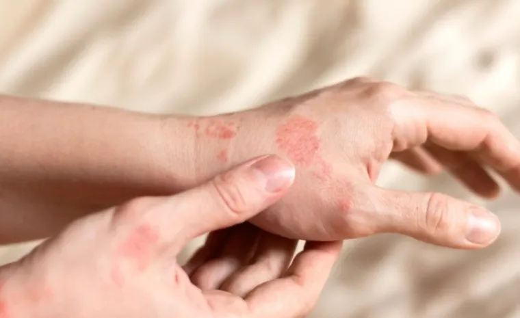 Zarazna bolest u hrvatskoj županiji: Među oboljelima i dijete, a nisu međusobno povezani