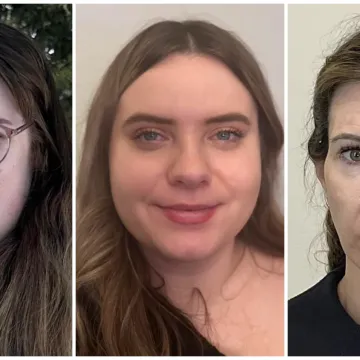 Podvrgnuli se estetskim zahvatima, pa od sebe napravili čudo: Neki su danas neprepoznatljivi