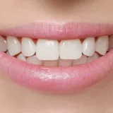 [KVIZ] Provjeri koliko zna&scaron; o ljudskim zubima?