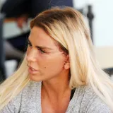 Estetski zahvati koji su &scaron;okirali svijet: Kako je reality zvijezda uni&scaron;tila prirodnu ljepotu?