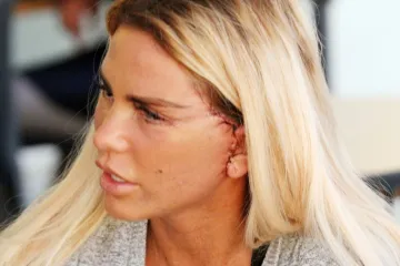 Estetski zahvati koji su &scaron;okirali svijet: Kako je reality zvijezda uni&scaron;tila prirodnu ljepotu?