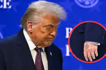 Trump opet snimljen s modricom i to na drugoj ruci: 'Uzimam veću dozu, želim rijetku krv'