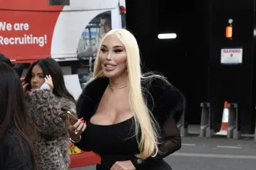 Nevjerojatna transformacija: Sad je bila uzbuđena, a pogledajte kako je prije izgledala