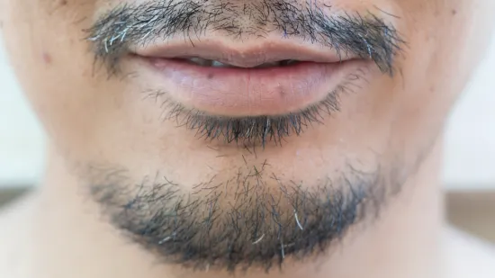 Madeže i mrlje na usnama ne biste smjeli ignorirati: 'Ovo su znakovi upozorenja'