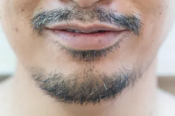 Madeže i mrlje na usnama ne biste smjeli ignorirati: 'Ovo su znakovi upozorenja'