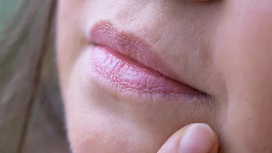 Ova pojava na licu prvi je znak starenja: Dermatolozi otkrivaju kako zadržati mladolik izgled