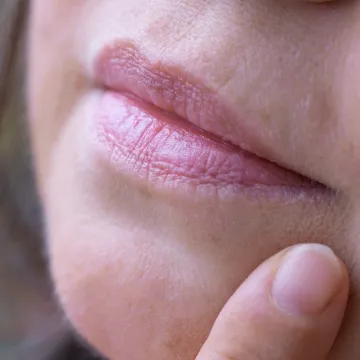 Ova pojava na licu prvi je znak starenja: Dermatolozi otkrivaju kako zadržati mladolik izgled