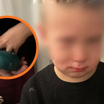 Mali prst u velikoj opasnosti! David je bio uvrijeđen, ali vjerovao je vatrogascima s pilom