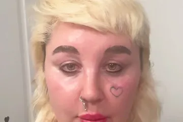 &Scaron;to se dogodilo jednoj od najvećih teen zvijezda? Danas ju malo tko može prepoznati