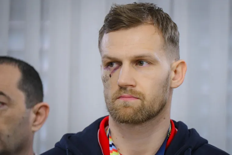 Ovako izgleda lice ranjenog Mandića dan nakon krvave bitke s Islandom