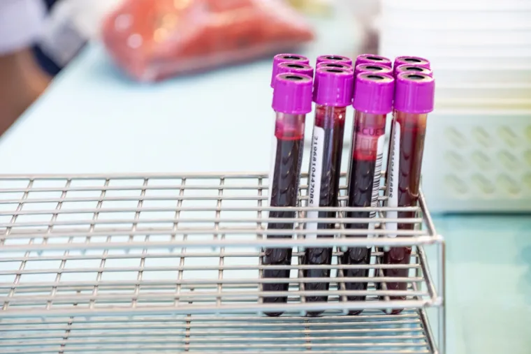 U Zagrebu otkrio: Dronovi kod nas prenose krv, a kirurzi imaju rengenski vid