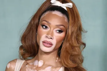 O njoj uvijek pričaju svi! Winnie Harlow zasjala na crvenom tepihu u neodoljivom izdanju koje oduzima dah