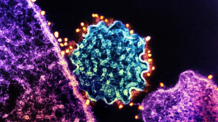 Opasni smrtonosni virus dignuo uzbunu, uvode se COVID mjere: 'Ovo će biti sljedeća pandemija'