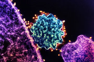 Opasni smrtonosni virus dignuo uzbunu, uvode se COVID mjere: 'Ovo će biti sljedeća pandemija'