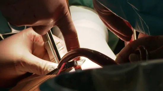 Traže se odgovori na tragičan ishod operacije kuka u Puli: 'Važno je postupati objektivno'