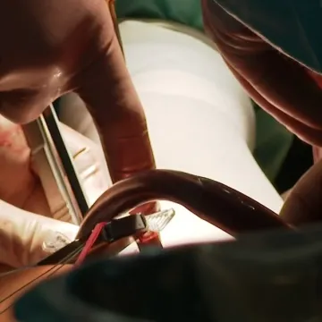 Traže se odgovori na tragičan ishod operacije kuka u Puli: 'Važno je postupati objektivno'