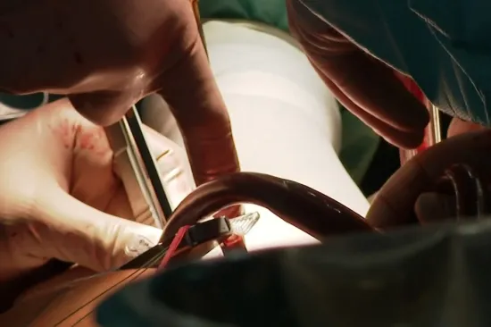 Traže se odgovori na tragičan ishod operacije kuka u Puli: 'Važno je postupati objektivno'