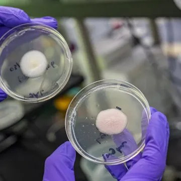 Ovaj &scaron;ećer mogao bi biti ključ za pobjedu smrtonosnih superbakterija otpornih na lijekove