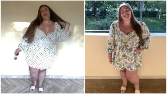 Rekli su joj da neće moći imati djecu, upla&scaron;ila se i žestoko smr&scaron;avila: Danas je prava manekenka