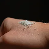 Na trži&scaron;tu se pojavio bijeli prah: Legalan je i dostupan tinejdžerima