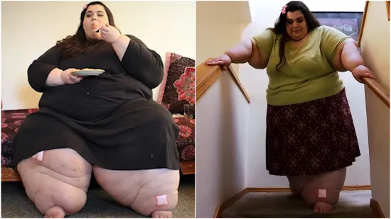 Zbog prekomjernih kilograma nije mogla hodati, a onda je napravila čudo: Danas izgleda sjajno