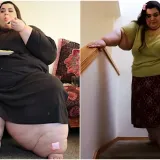 Zbog prekomjernih kilograma nije mogla hodati, a onda je napravila čudo: Danas izgleda sjajno